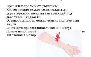 Как остановить кровотечение при ранении артерии ответ пдд