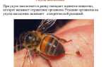 Как вытащить жало из пригоревшего в появлике