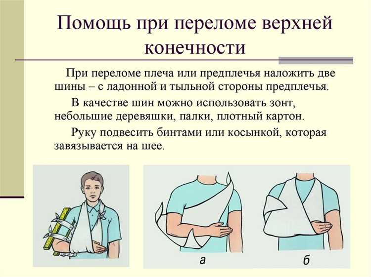 Как оказывается первая помощь при переломах пдд Как оказывается первая помощь при переломах пдд