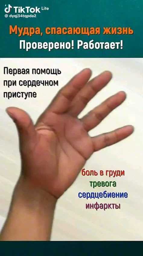Слабое затягивание жгута не останавливает кровотечение, а лишь пережимает вены, усиливая венозный застой. Правило: жгут накладывают до исчезновения пульса ниже раны и остановки кровотечения. Если кровь продолжает сочиться – жгут затянут недостаточно. Контроль эффективности: undefinedкожа ниже жгута должна побледнеть, а конечность – похолодеть</strong>.»></p>
<p>Использование нестерильных материалов для перевязки увеличивает риск инфицирования раны. Даже при экстренной помощи нужно применять <strong>индивидуальный перевязочный пакет</strong> или чистую ткань, проглаженную утюгом. Грязные бинты, платки или траву в рану не кладут – это прямой путь к сепсису.</p>
<p>Неправильная фиксация давящей повязки приводит к её сползанию и возобновлению кровотечения. Бинт накладывают <strong>спирально, с нахлёстом в 2/3 ширины</strong>, начиная с узкого места конечности. При артериальном кровотечении давление должно быть максимальным в проекции повреждённого сосуда. Если повязка пропиталась кровью – поверх неё накладывают ещё один слой, не снимая предыдущий.</p>
<p>Самостоятельное извлечение инородных предметов из раны усиливает кровотечение и повреждает окружающие ткани. Острые осколки, ножи или стекло фиксируют <strong>валиками из бинта</strong> и накладывают повязку вокруг предмета. Удаление проводят только в стационаре под контролем хирурга.</p>
<p>Применение льда или снега непосредственно на рану вызывает обморожение и усугубляет повреждение тканей. Холод используют только для <strong>сужения сосудов</strong>, прикладывая через слой ткани на <strong>10–15 минут</strong> с интервалом в 30 минут. Прямой контакт со льдом приводит к некрозу кожи за <strong>5–7 минут</strong>.</p>
<p>Неправильное положение пострадавшего при кровопотере ускоряет развитие шока. При артериальном кровотечении конечности <strong>поднимают выше уровня сердца</strong>, но только если нет переломов. Пострадавшего укладывают на спину с приподнятыми ногами на <strong>30–45 см</strong>, чтобы обеспечить приток крови к мозгу. Вертикальное положение усиливает гипоксию.</p>
<p>Отказ от вызова скорой помощи при видимой остановке кровотечения опасен скрытым внутренним кровотечением. Даже если жгут или повязка остановили наружное кровотечение, пострадавший может потерять до <strong>40% ОЦК</strong> в полости тела. Контроль состояния: <strong>частота пульса выше 100 уд/мин, бледность, холодный пот</strong> – показания для немедленной госпитализации.</p>
<h2>Как правильно зафиксировать время наложения жгута и передать информацию медикам</h2>
<p><img decoding=