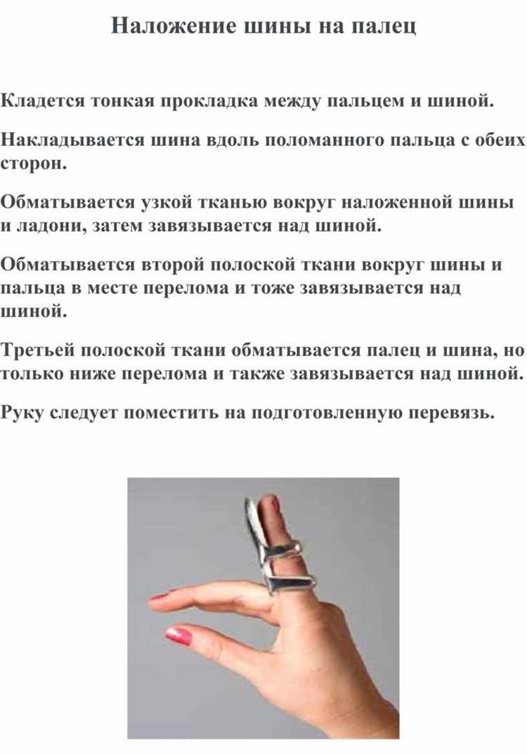 Признаки обморожения тканей под жгутом и действия при их обнаружении