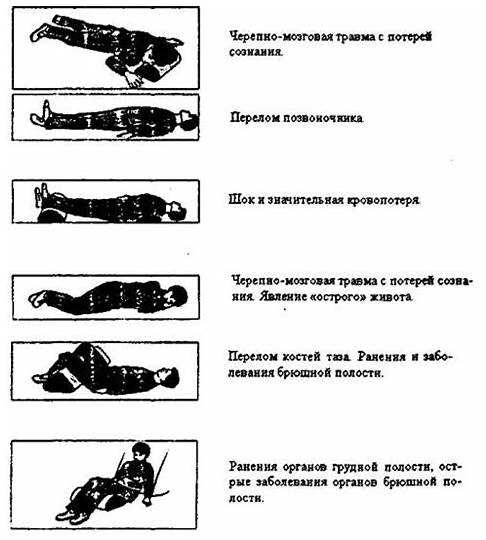 Пошаговая техника фиксации ног и таза в безопасном положении